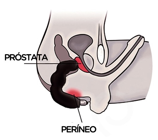 Massageador para a Próstata com Vibrador My Boy Expert - Preto