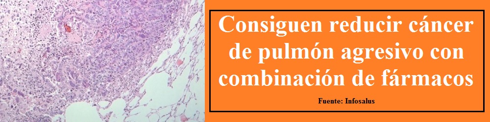 Consiguen reducir el cáncer de pulmón más agresivo con una combinación de fármacos