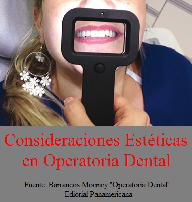 CONSIDERACIONES ESTÉTICAS EN OPERATORIA DENTAL