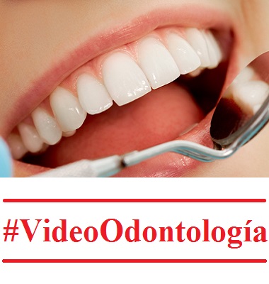 #VideoOdontologia: Videos de odontologia, cirugia oral, bucal, endodoncia