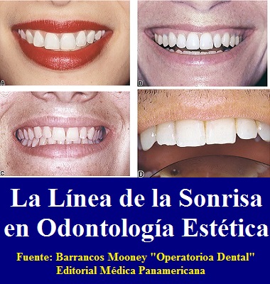 LA LÍNEA DE LA SONRISA EN ODONTOLOGÍA ESTÉTICA