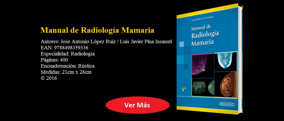 MANUAL DE RADIOLOGÍA MAMARIA - Jose Antonio López Ruiz - ISBN 9788498359336