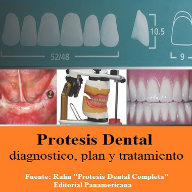 Protesis dental, diagnostico plan y tratamiento